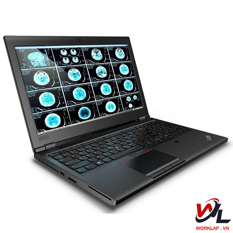 Mua laptop Dell, HP, Asus, Lenovo, Macbook xách tay có được bảo hành